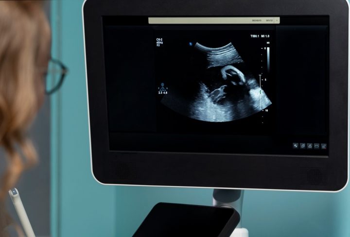 4D Scan for Pregnancy